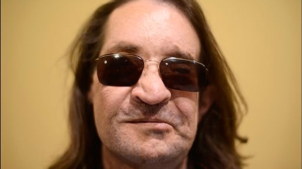 121413_face_transplant_lg.jpg
